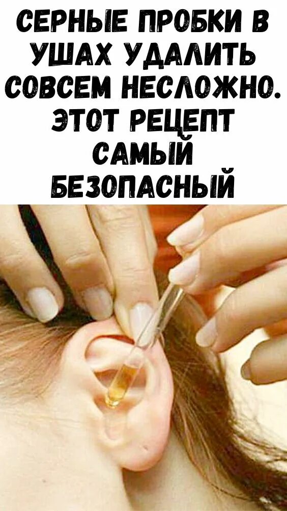 Как самому удалить пробки. Избавление от серной пробки в ухе.