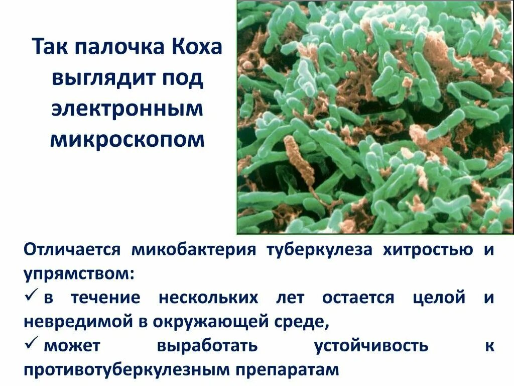 Палочка коха заболевание. Палочка Коха Mycobacterium tuberculosis. Туберкулез палочка Коха под микроскопом.