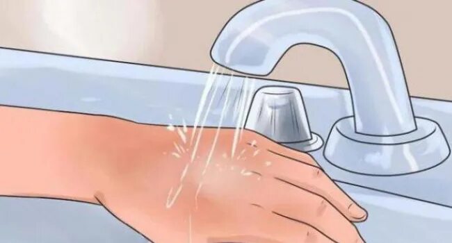 Почему нельзя лопать ожог. Почему нельзя лопать ожог. Почему нельзя лопать ожог. Почему нельзя лопать ожог. Ожоги нельзя промывать водой.