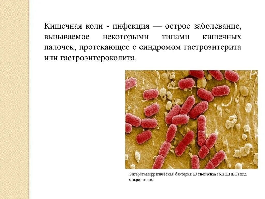 Признак палочки. Кишечная коли инфекция патанатомия. энтерогеморрагические кишечные палочки. кишечная палочка вызывает заболевания. кишечные инфекции эшерихии.