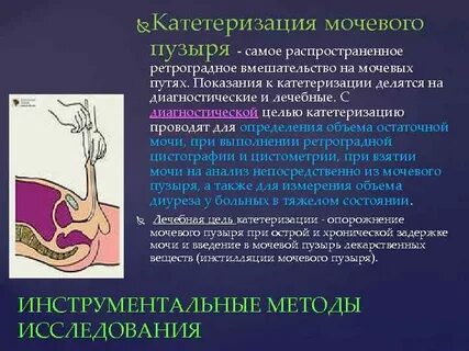 Постановка катетера манипуляция