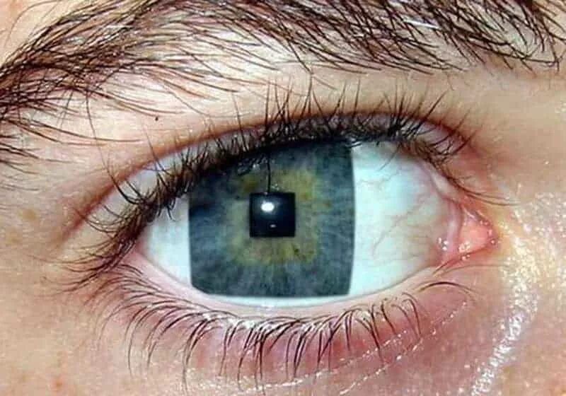 Квадратный глазок. Квадратные глаза. Квадратные зрачки. Квадратные зрачки у человека. Прямоугольные зрачки.