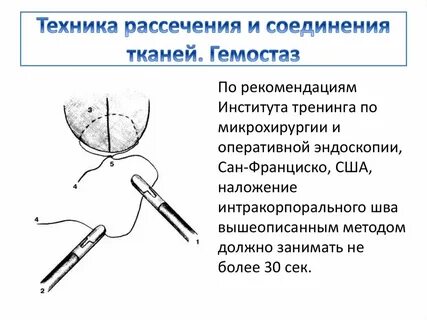Соединение тканей