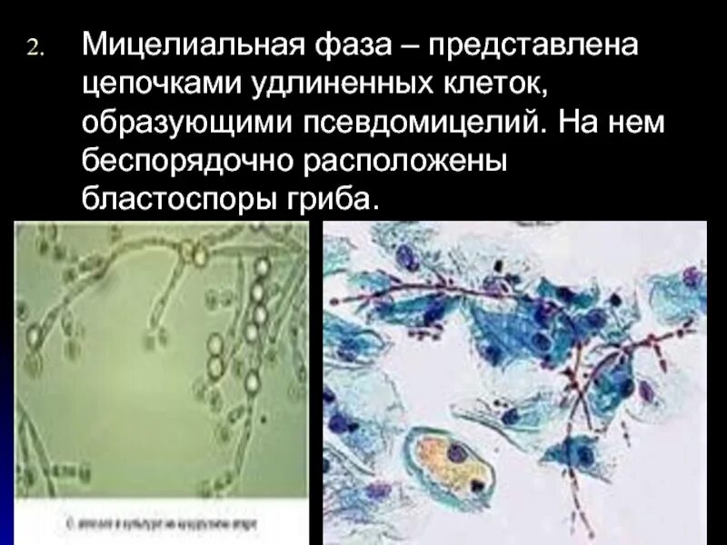 Дрожжеподобные грибы: псевдомицелий. Грибы кандида микроскопия. Мазок на флору воспаление. Грибок псевдомицелий в мазке. Бластоспоры в мазке у женщин норма.