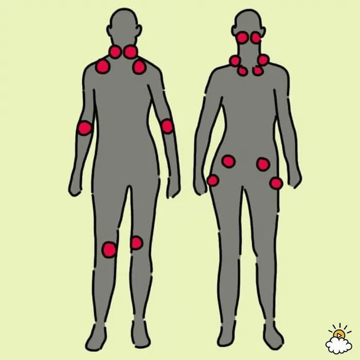 Больные места у человека. Болевые места человека. Больные места человека на теле. Самое больное место у человека. Самые больные точки человека.