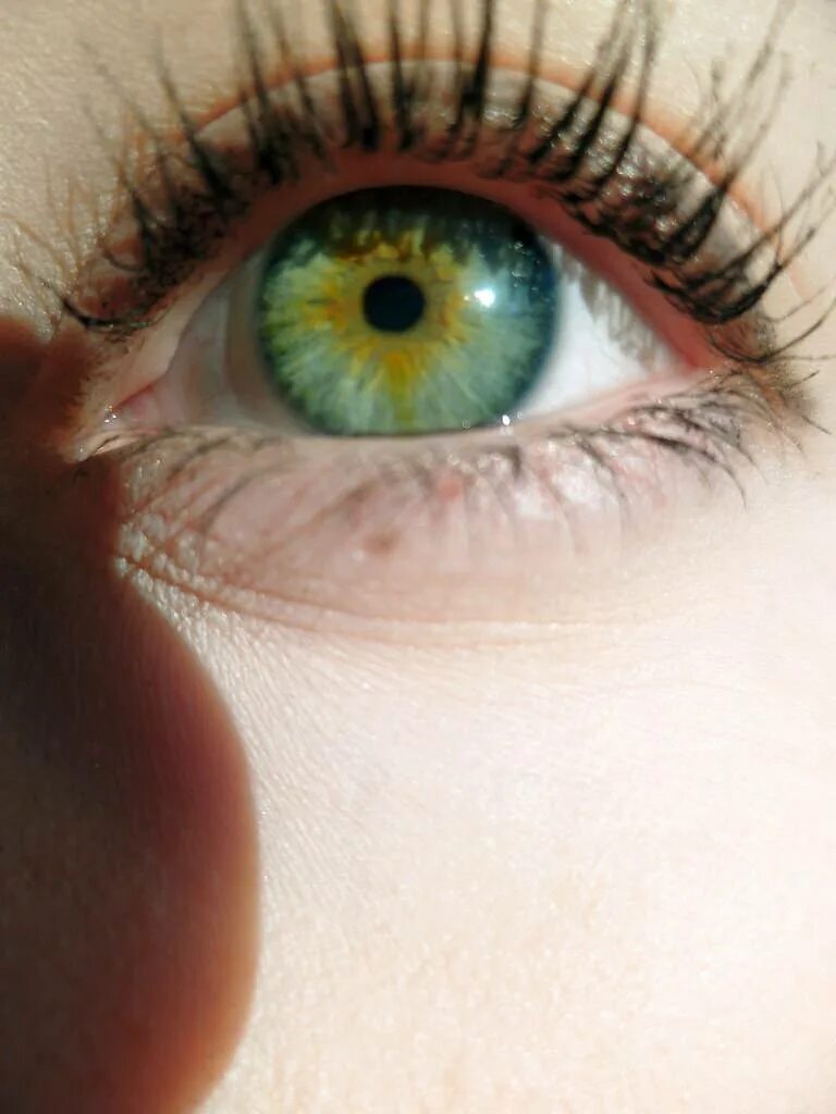 Зелено голубо желтые глаза. Гетерохромия радужной оболочки. Гетерохромия Радужки глаз. Центральная гетерохромия голубой и Карий. Центральная гетерохромия зеленый Карий.