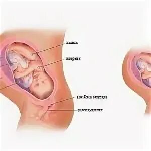 38 Недель беременности болят. Живот на 38 неделе беременности.