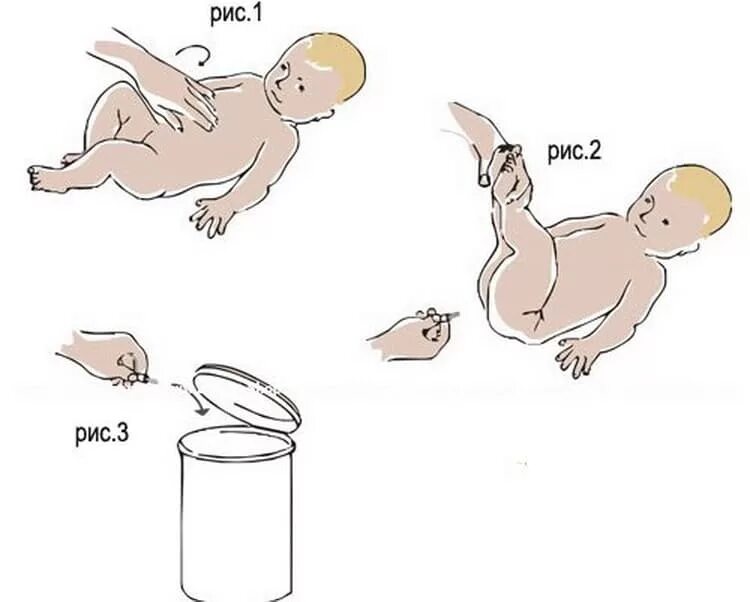 Колики трубочки. Газоотводная трубка для новорожденных как пользоваться. Как правильно вставлять газоотводную трубку новорожденному. Как правильно ставить газоотводную трубочку новорожденному. Как правильно вставить газоотводную трубочку новорожденному ребенку.