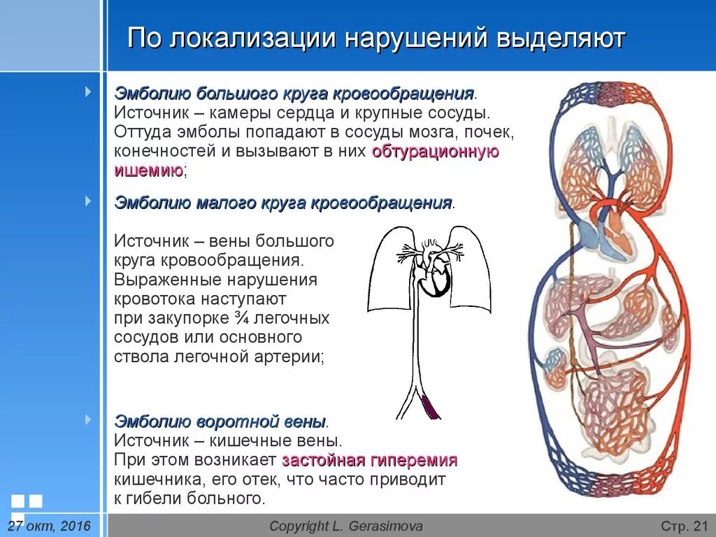 Нарушение кровообращения малого круга. Схема эмболии большого и малого кругов кровообращения. Тромбоэмболия артерий большого круга кровообращения. Эмболия большого круга кровообращения. Эмболия сосудов малого круга кровообращения.