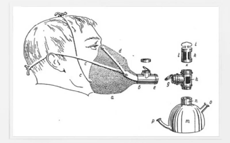 эфирный наркоз