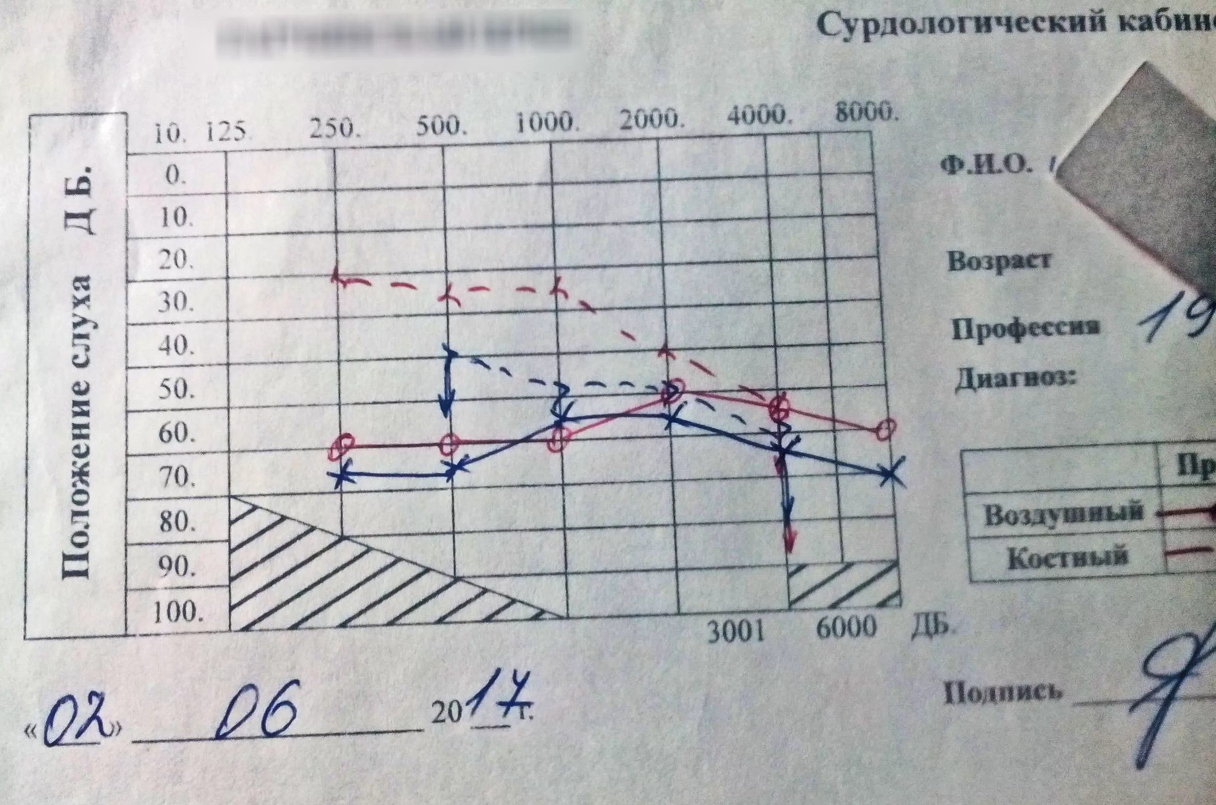 Как улучшить слух при тугоухости