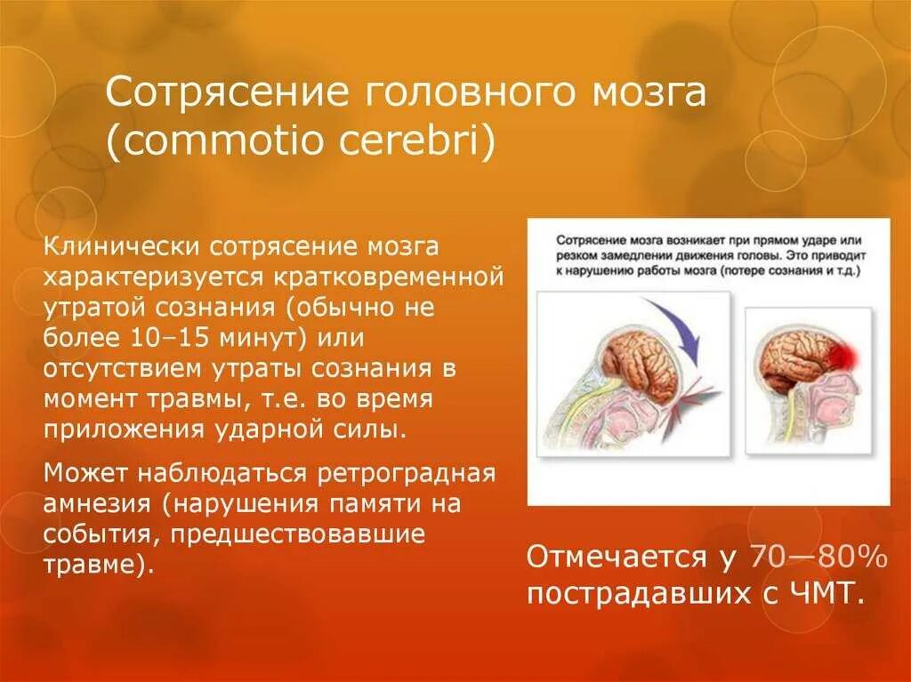 Сотрясение в год. Клинические проявления сотрясения головного мозга. Клиническая картина сотрясения головного мозга характеризуется. При сотрясении головного мозга. Клинические симптомы сотрясения головного мозга.