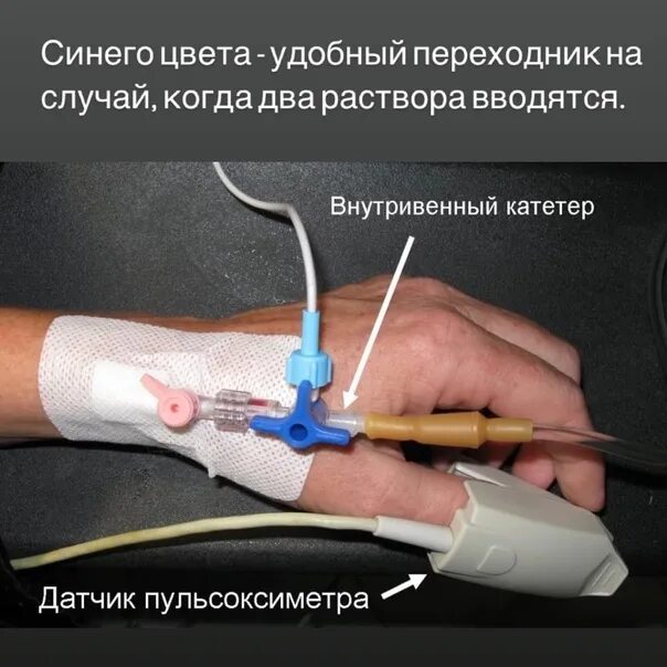 Куда вставляется катетер. Периферический катетер venflon. периферический катетер и система. венозный катетер капельница. катетер венозный центральный периферически вводимый.