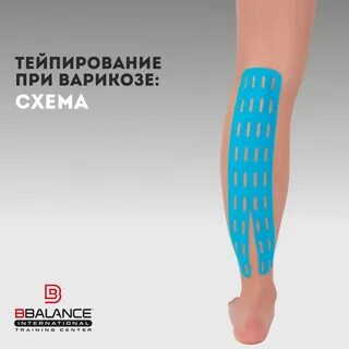 Тейпирование перфорированными тейпами