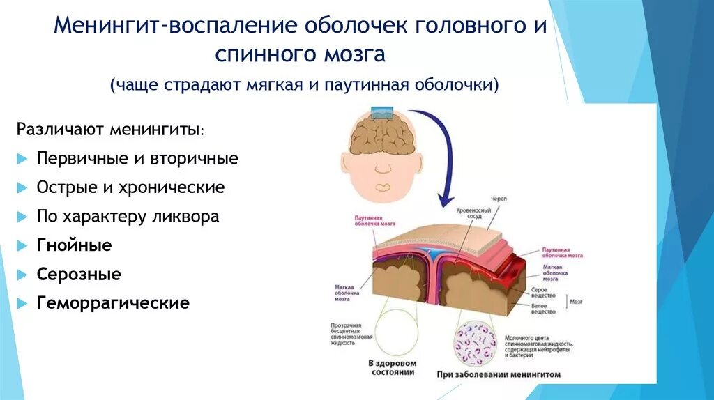 Инфекционные поражения мозга. Воспалительные заболевания оболочек головного мозга. Менингит-воспаление оболочек спинного мозга. Воспаление мозговой оболочки головного мозга признаки. Симптомы поражения оболочек головного и спинного мозга.