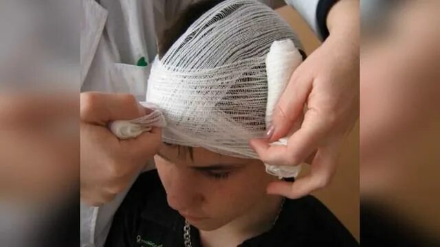 Повязка шапочка гиппократа техника наложения. Чепец и шапочка Гиппократа. Чепец Гиппократа повязка. Перевязка головы шапочка Гиппократа. Бинтование головы шапочка Гиппократа.