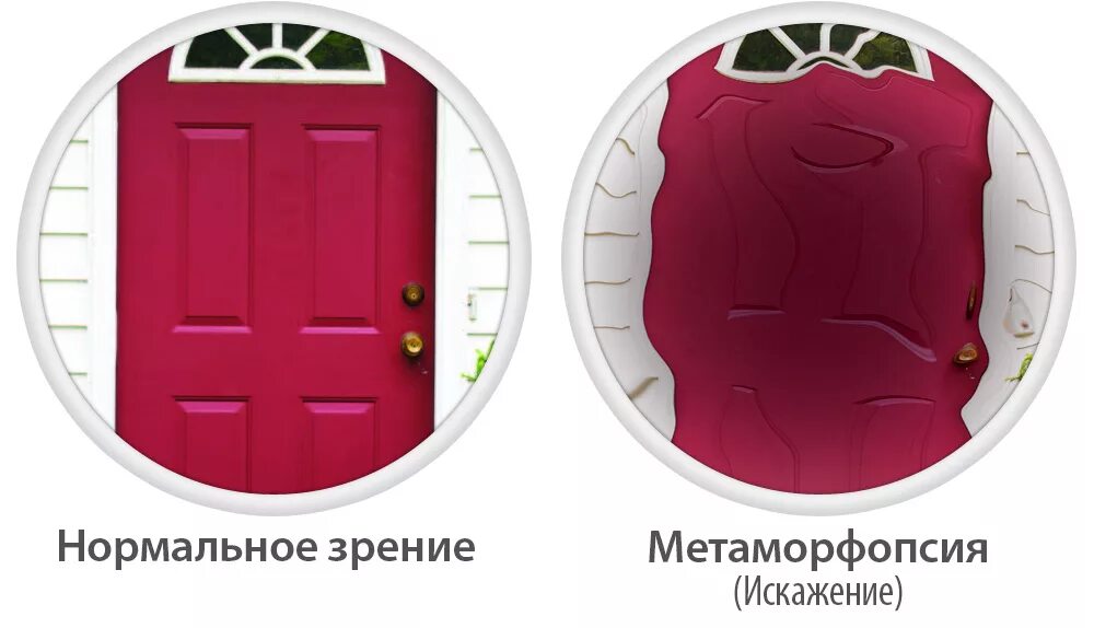 Вижу искаженные предметы