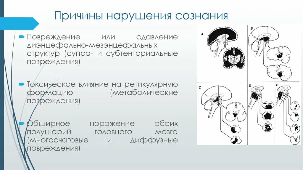 Причины нарушения сознания. Количественные формы нарушения сознания. Нарушения сознания классификация. Причины угнетения сознания. Количественных и качественных нарушениях