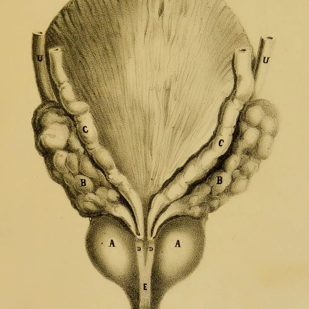 Предстательной железы анатомия анатомия. Аденома простаты анатомия. Семенные пузырьки везикулит. Анатомия простаты и семенных пузырьков.