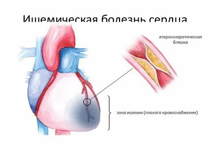 Тяжелый век тяжелые сердца