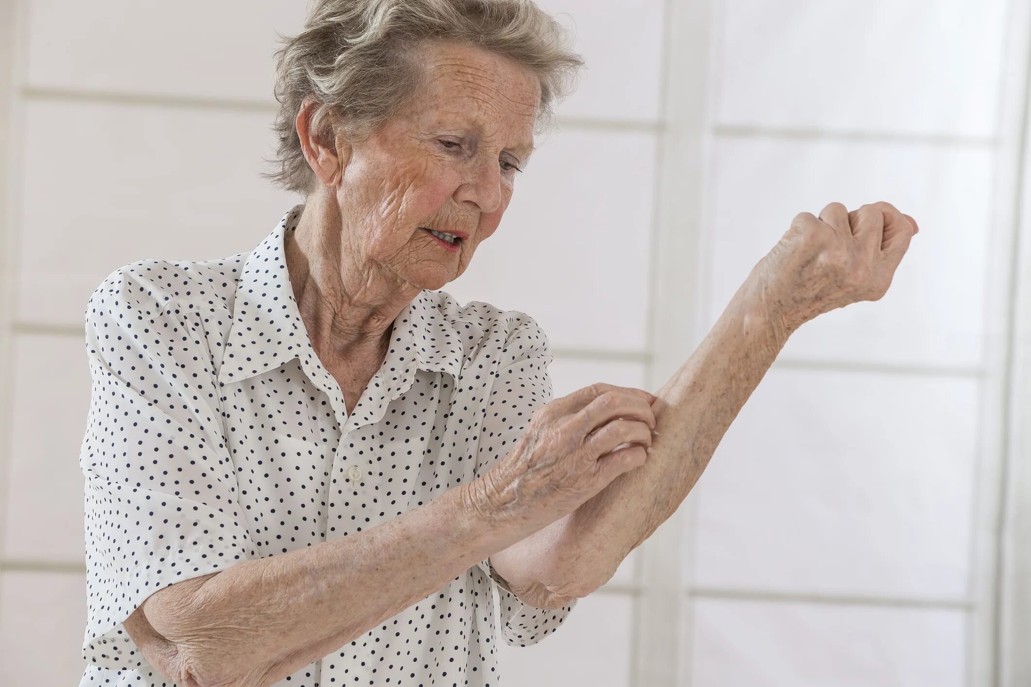 Пах женщины после 60 лет. Заболевания кожи у пожилых. Гигиена в пожилом возрасте.