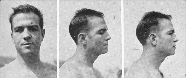 некрасивая форма черепа. мужское лицо сбоку. брахицефалия антропология. правильная форма черепа сбоку. скошенный подбородок.