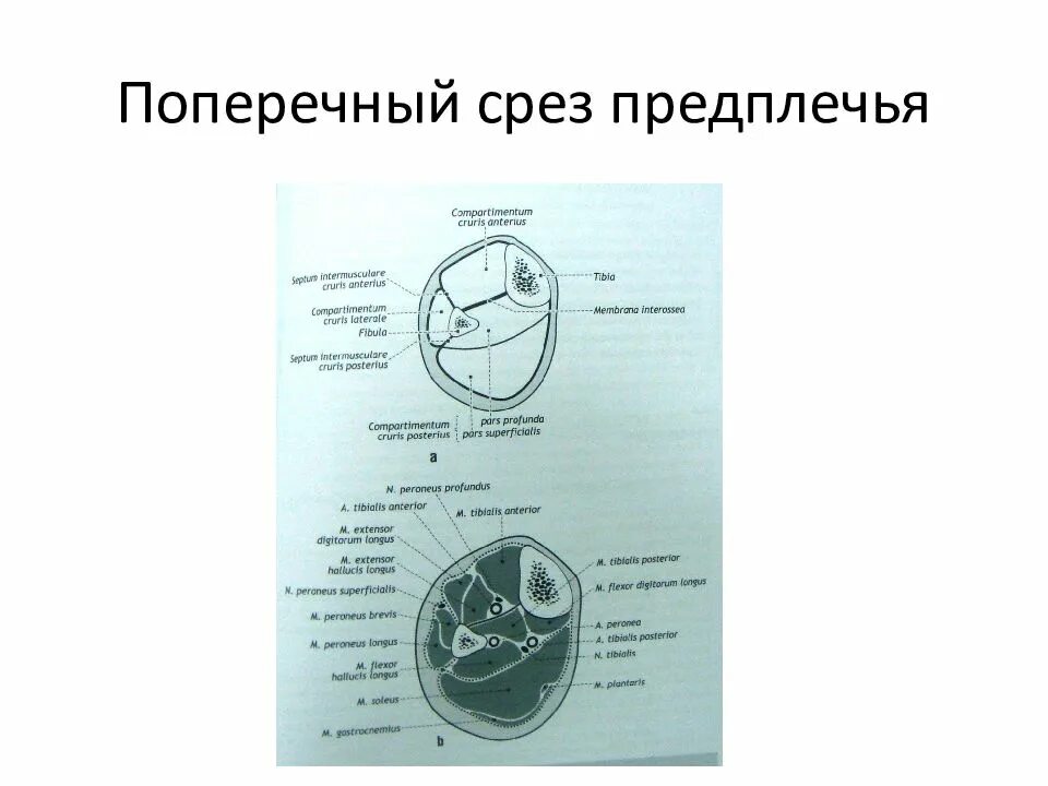 Топографические срезы. Поперечный разрез предплечья схема. Поперечный распил предплечья в средней трети. Поперечный срез предплечья схема. Схема горизонтального распила предплечья.