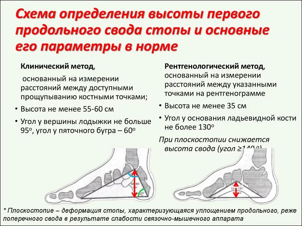 Плоскостопие 3 степени сколько градусов. Продольное плоскостопие угол схема. Плоскостопие 3 степени угол свода стопы. Нормы продольного свода стопы. Плоскостопие 3 степени высота свода стопы.