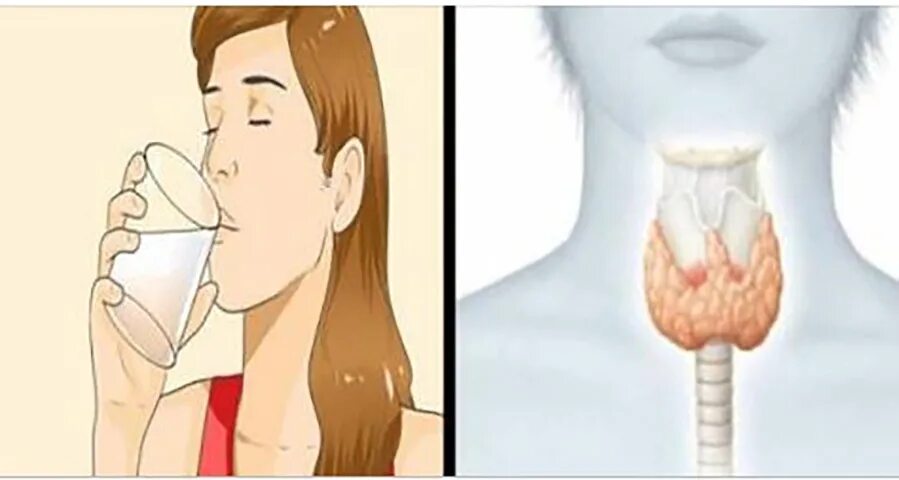 Исцеление щитовидной железы. Проверь щитовидную железу. Щитовидная железа похудение. Как проверить щитовидную.