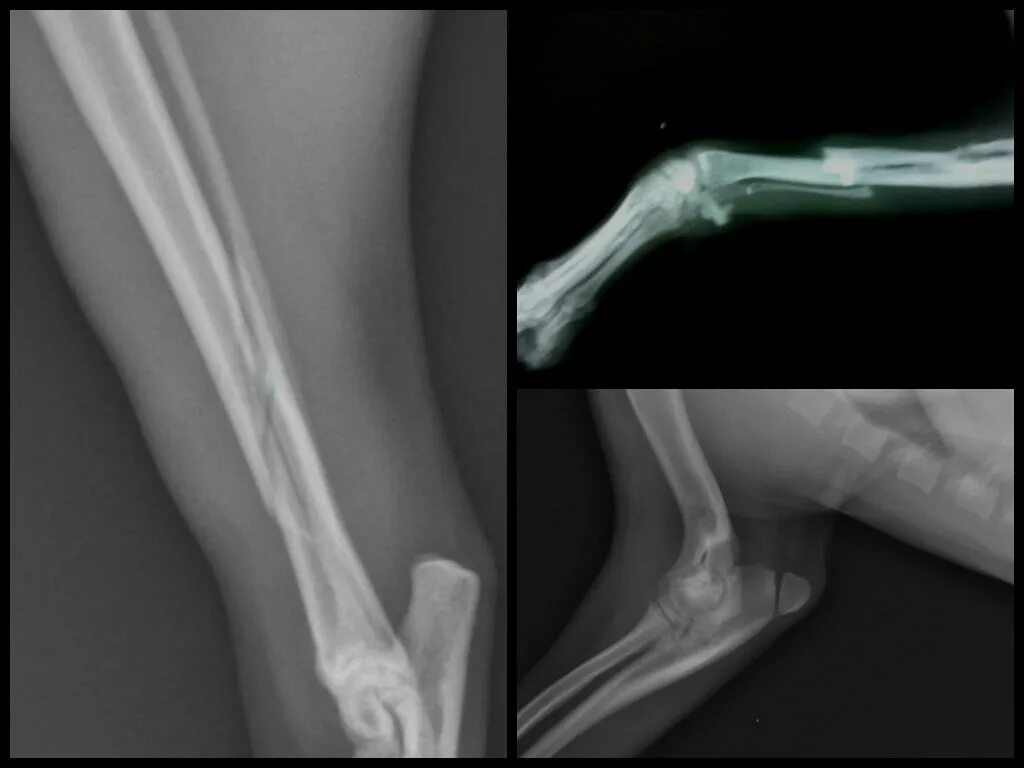 Перелом со смещением собак. Перелом предплечья рентген остеосинтез. Рентген лучевой кости собаки. Перелом берцовой кости у собаки. Остеосинтез кошка оскольчатый перелом.