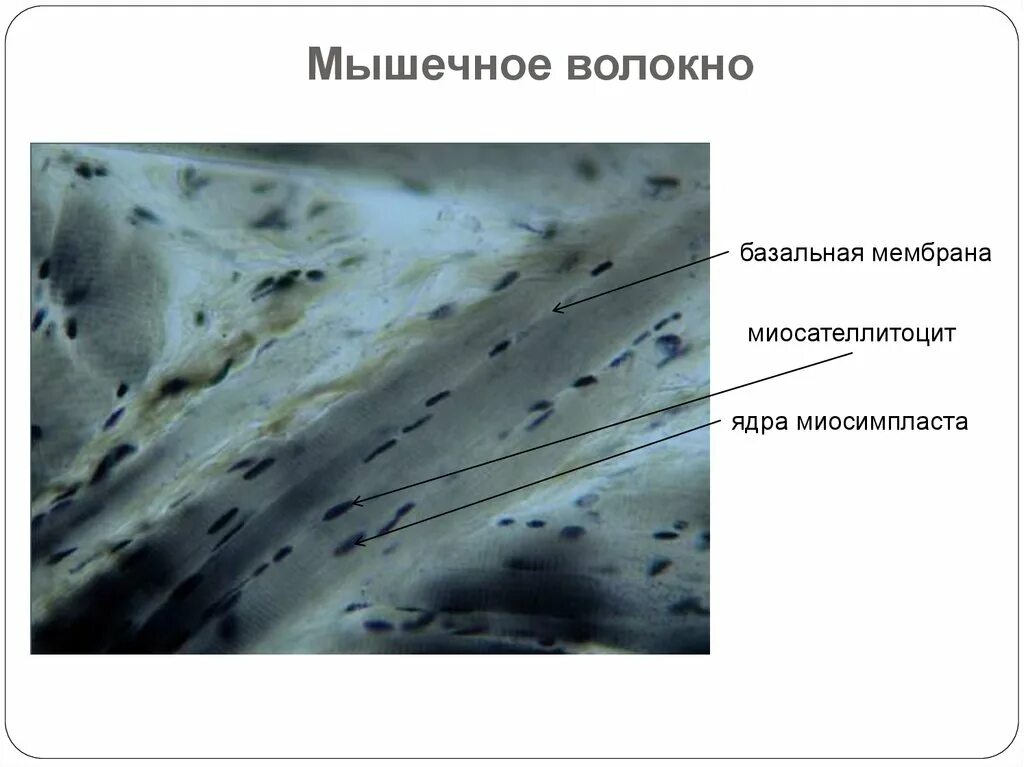 Базальная мембрана мышечного волокна. Миосателлитоциты. Миосателлитоцит строение. Базальная мембрана миосимпласта. Мембрана мышечного волокна