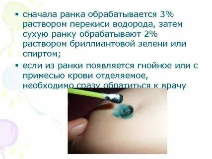 Обработка пупочной ранки алгоритм