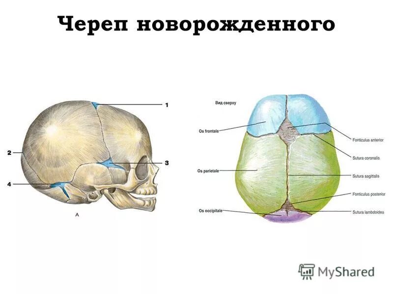 Соединения костей черепа новорожденного. Череп новорожденного вид сбоку вид сверх. Кости свода черепа анатомия.