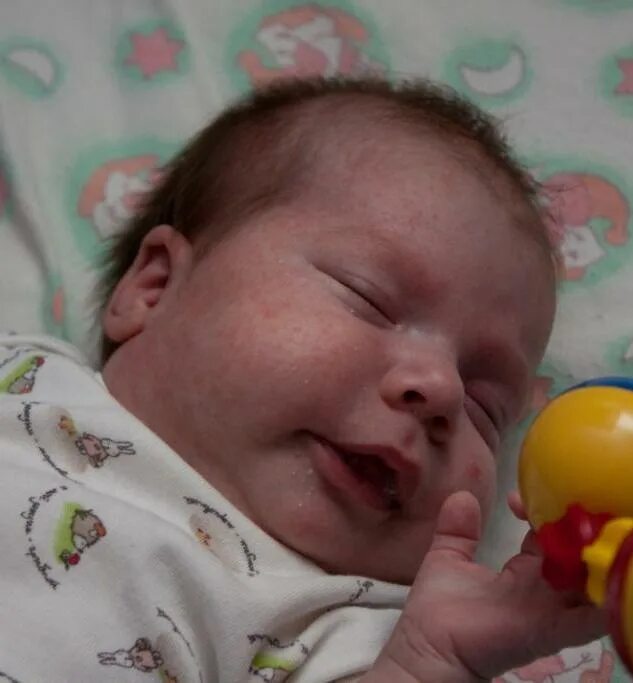 новорожденный ребенок цветет. неонатальный цефалический пустулез. неонатальный цефалический пустулез. новорожденный ребенок цветет. цветут дети новорожденные.