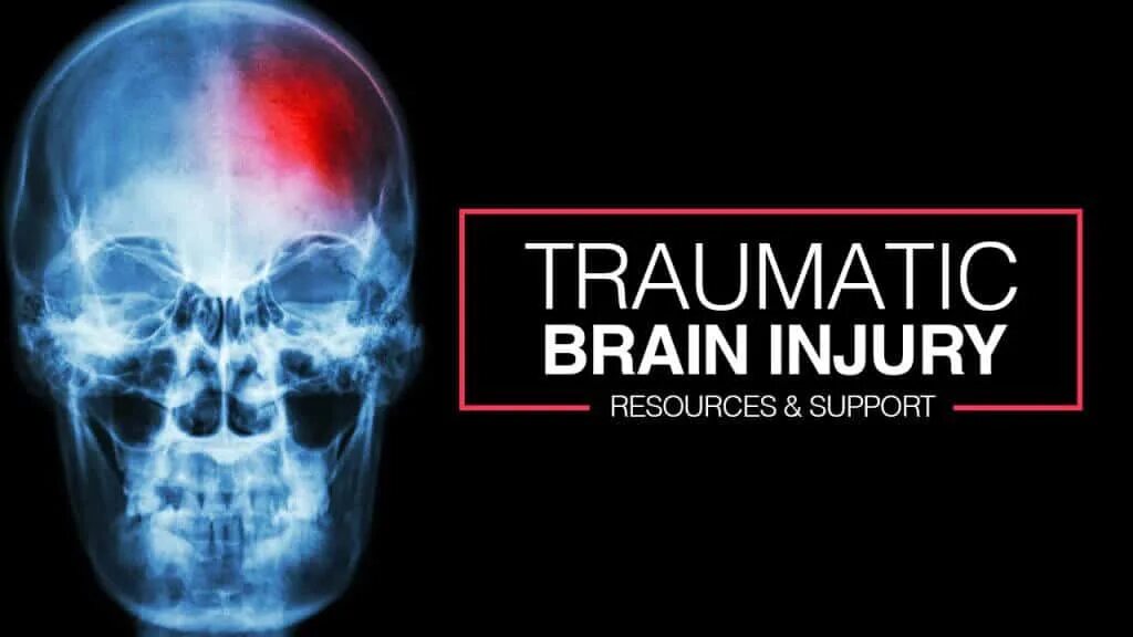 Brain injury support.