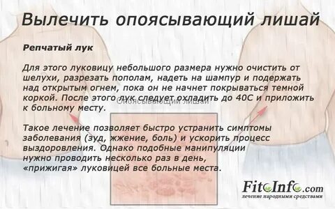 Опоясывающий герпес психосоматика