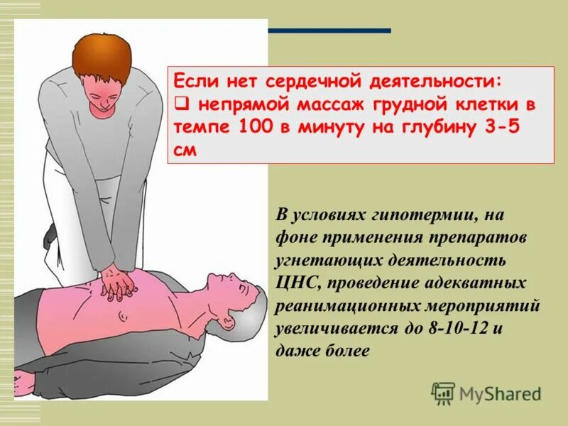 Проведение сердечно-легочной реанимации двумя спасателями алгоритм. Сердечно легочная реанимация проводимая двумя людьми. Частота компрессий грудной клетки при проведении слр. При проведении сердечно-легочной реанимации пострадавший. Давление на грудину при проведении сердечно-легочной реанимации.