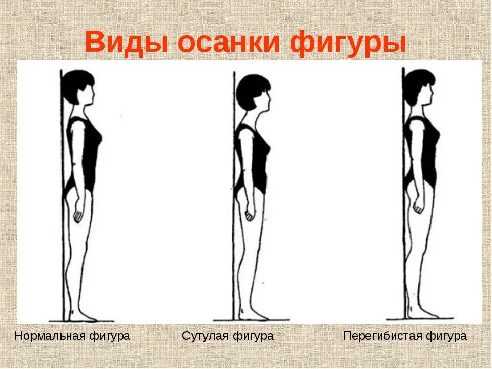 Как правильно держать спину. Искривление позвоночника сутулость. Упражнения для исправления сутулости осанки у. Упражнения для детей от сутулости и сколиоза. Гимнастика искривление осанки упражнения.