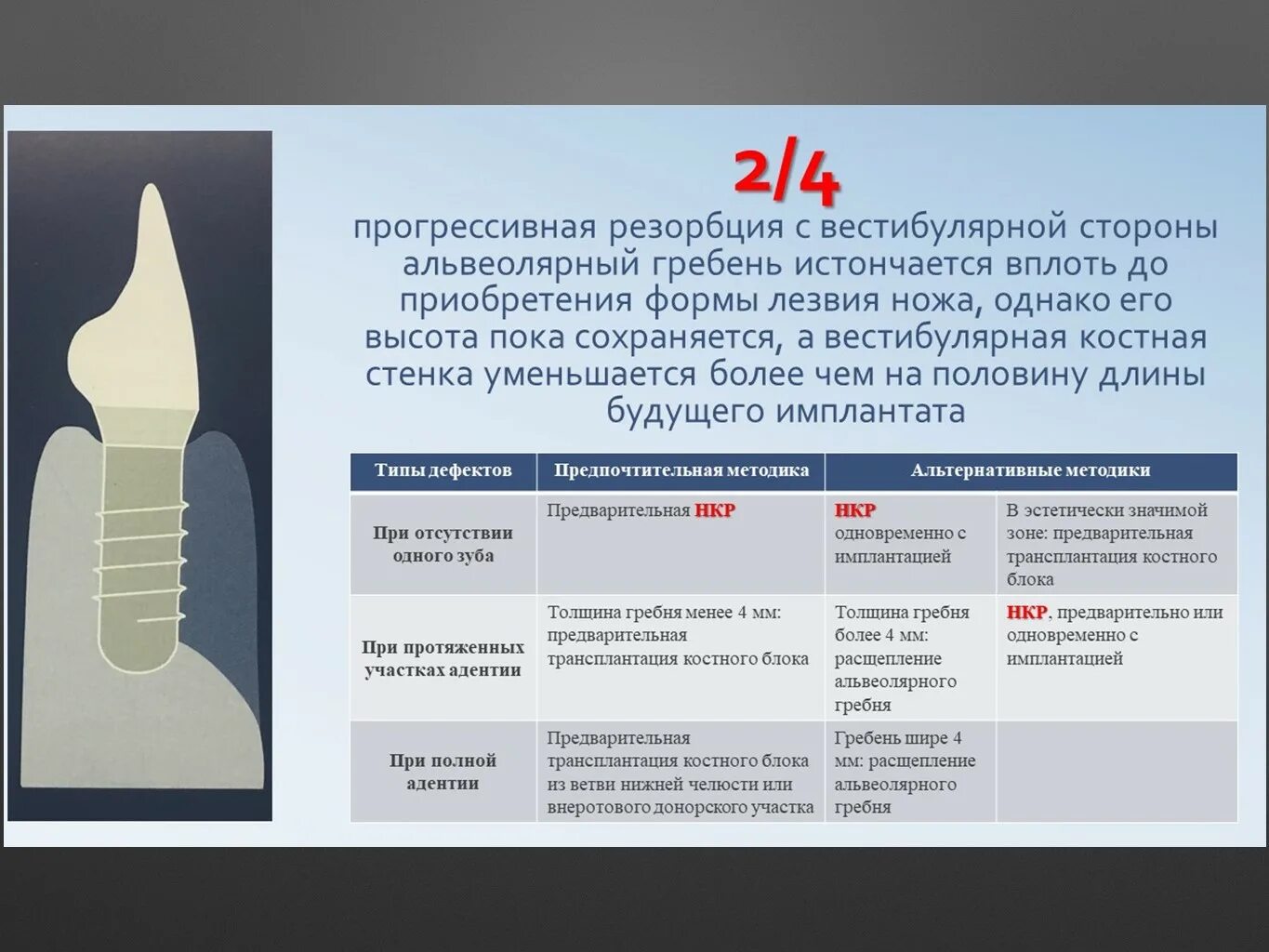 Типы резорбции
