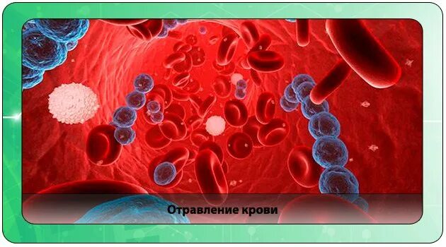 Яды действующие на кровь. Отравление кровяными ядами. Отравление отравой