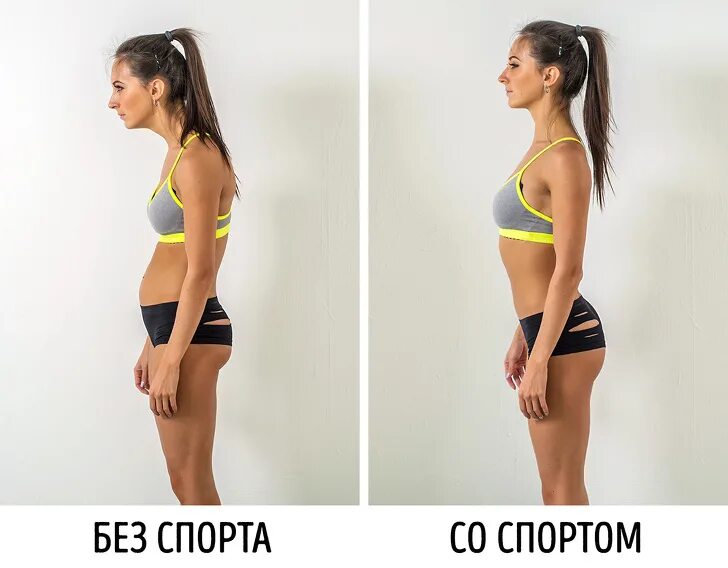 Осанка до и после упражнений. Осанка до после девушка. Осанка девушки с боку. Девушка с плохой осанкой