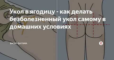 Укол в ягодицу схема самостоятельно