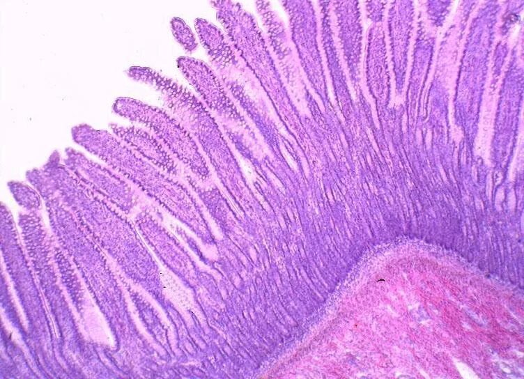 Вырост слизистой оболочки. Тонкий кишечник гистология препарат. Тонкая кишка гистология препарат. Срез тонкой кишки препарат гистология. Эпителий тонкой кишки гистология.
