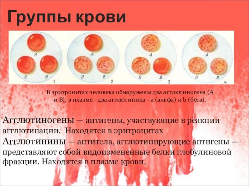 Антигены эритроцитов человека. Антигены эритроцитов 2 группы крови. эритроциты агглютиногены в 1 гр крови. агглютинация эритроцитов группа крови. агглютиногены эритроцитов 2 группы крови.