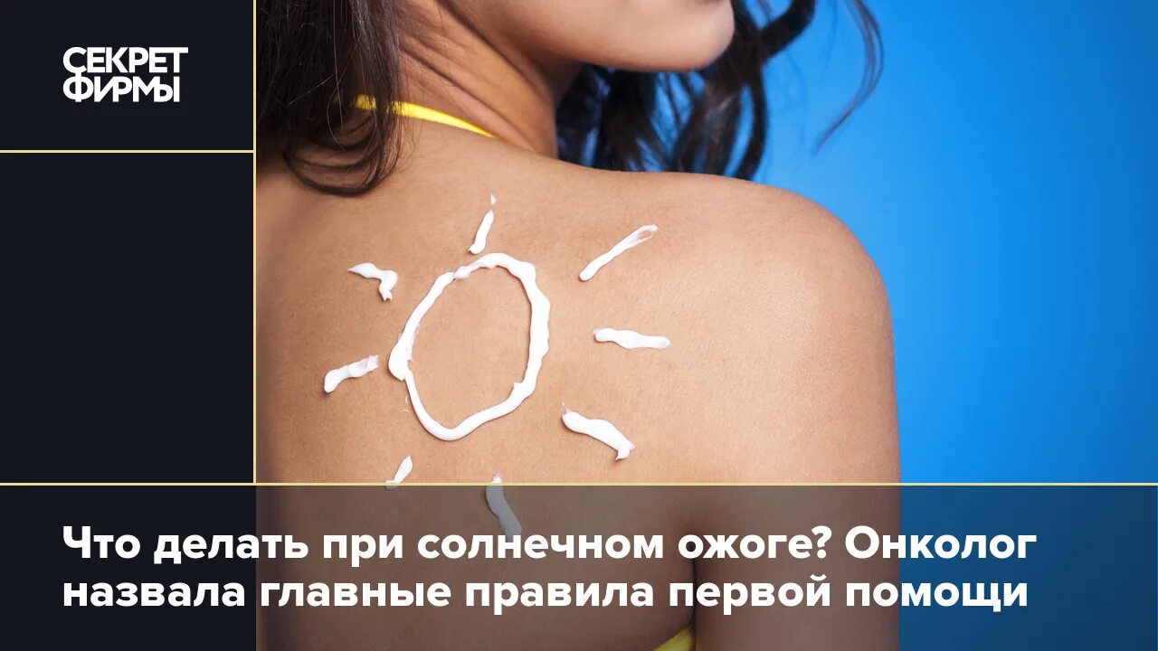 Как помочь коже при солнечном ожоге. Как помочь коже при солнечном ожоге