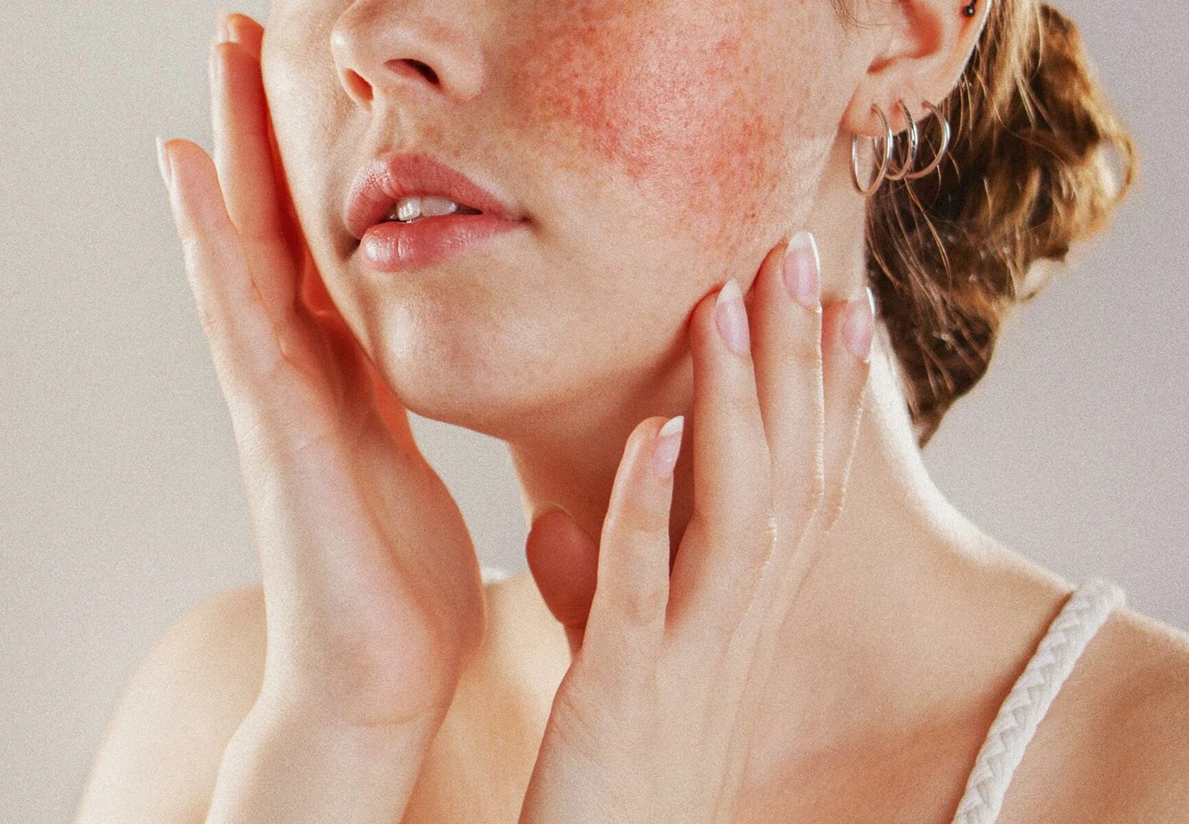 Крем против розацеа и куперозе. Крем 40мл. Сухая и чувствительная кожа. Uriage розельян маска для лица против покраснений 40мл. Косметика для кожи с покраснением лица.