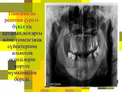 Порнографиялық тіс дәрігерлерінің суреттері