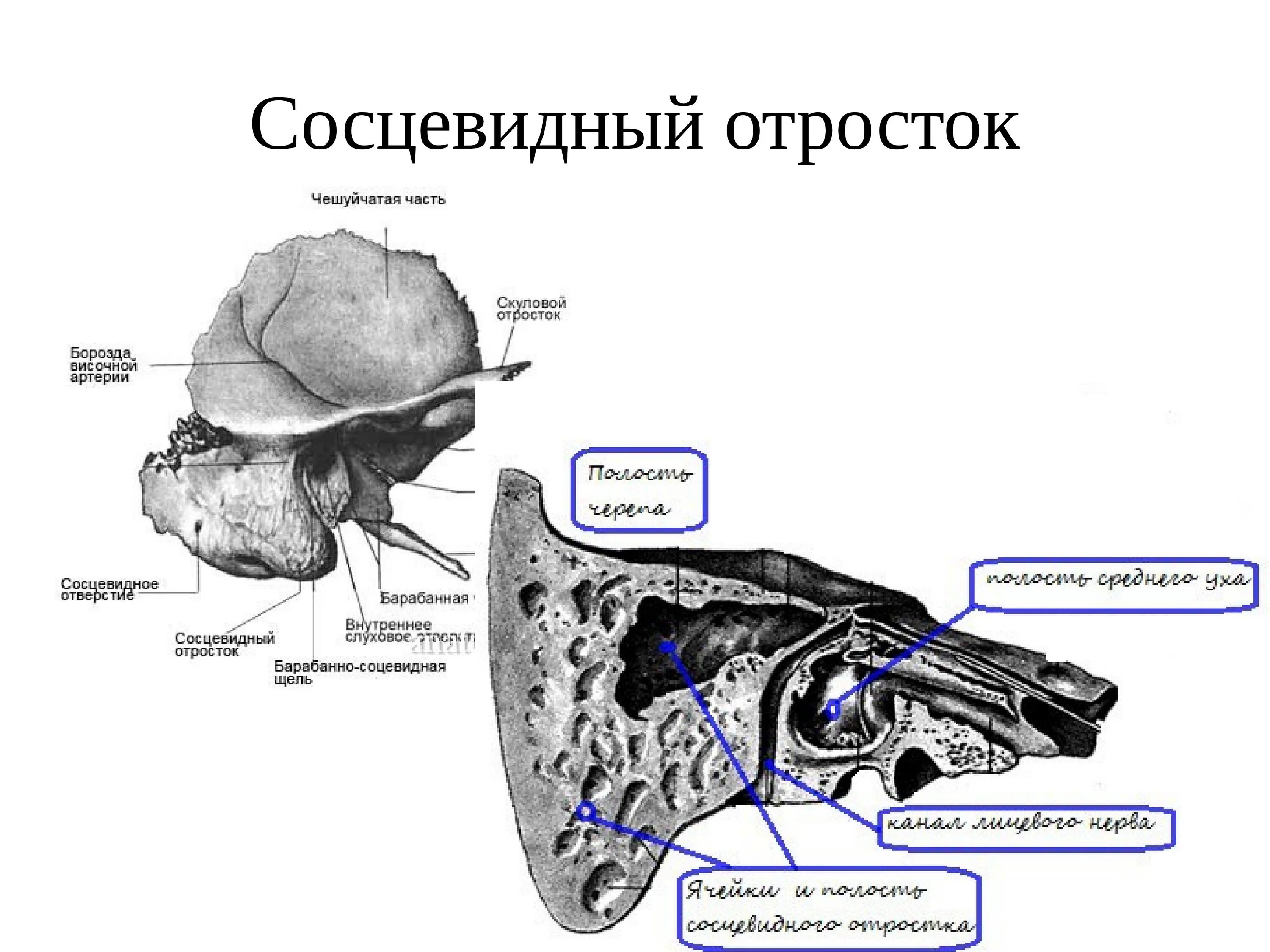 Строение кости сосцевидного отростка. Сэцевидный о Росток весочной кости. Сосцевидный отросток височной кости анатомия. Анатомия среднего уха и сосцевидного отростка.