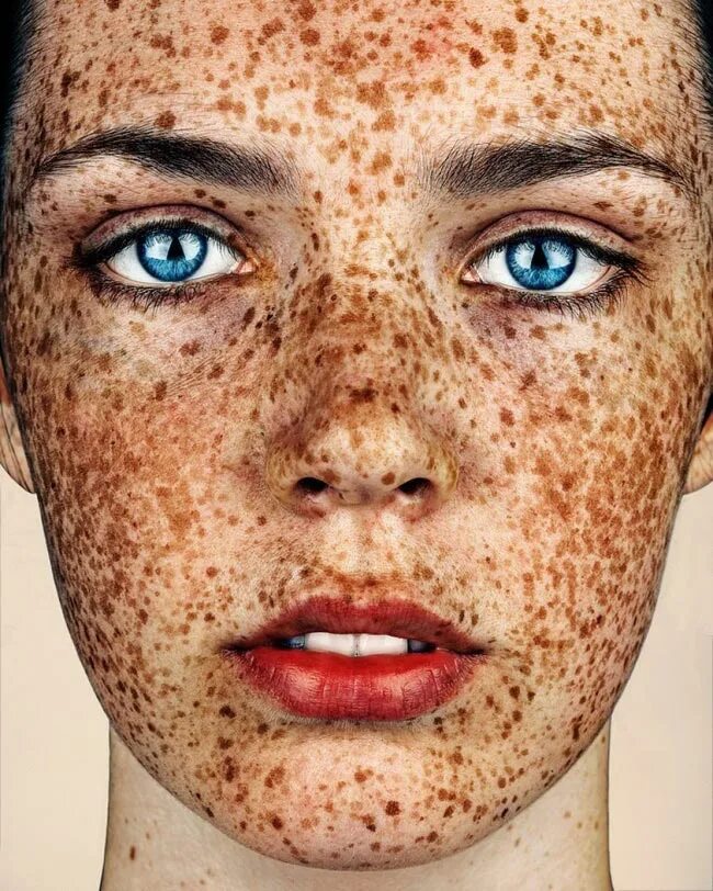 Многие люди с недостатками. Веснушки на лице. Многие люди с недостатками. Девушка с проблемной кожей. Лицо девушки для ретуши.