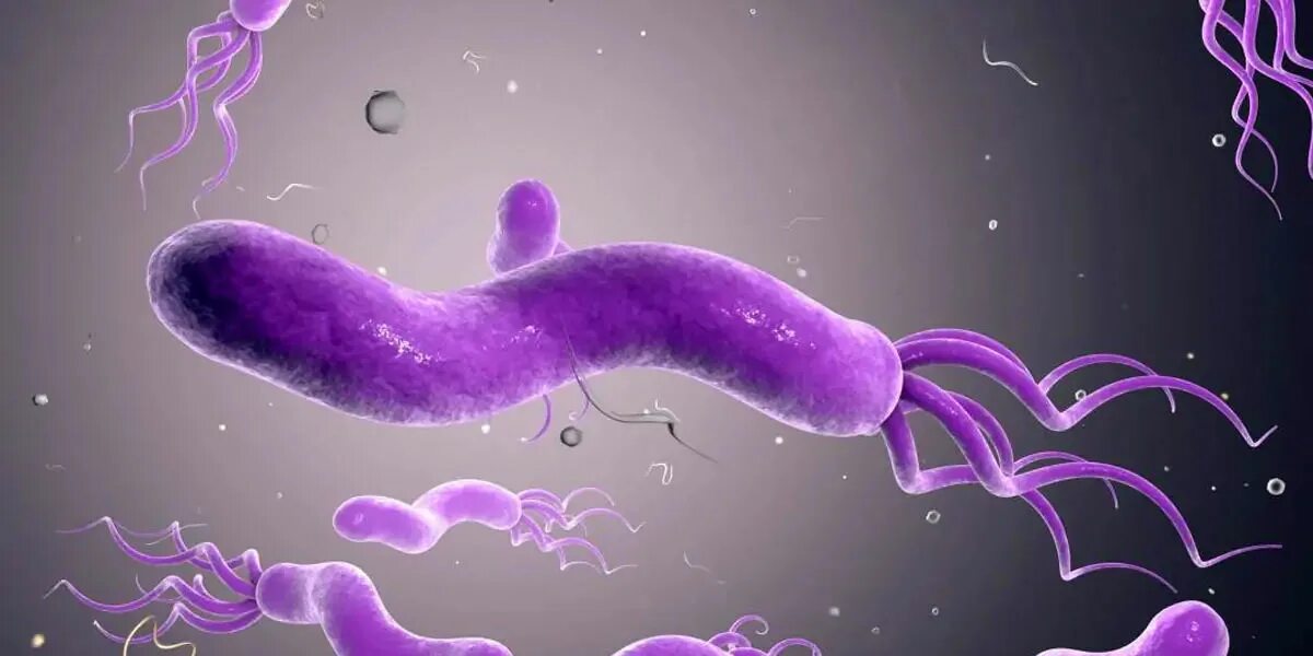 Состав желудочной слизи. Слизистая оболочка желудка пищеварительный сок. Поражение клеток желудка выделяющих слизь приводит к. Слизистый барьер жкт. Желудочный сок строение желудка.